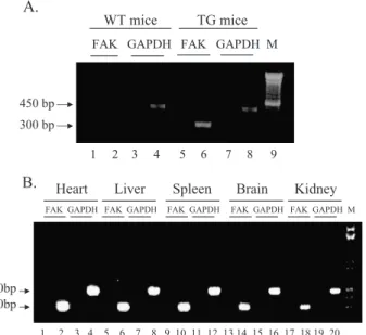 Fig. 3. Expression of transgenic FAK in vascular ECs. (A) Alignment of chicken FAK sequence with the corresponding sequence of murine FAK.