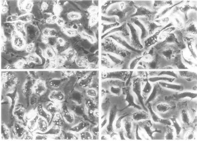 Fig. 4. In vitro phagocytosis by peritoneal macrophages of MRBC opsonized with either 34-3C (A), 105-2H (B), 31-9D (C), or 4C8 (D) anti-MRBC mAb