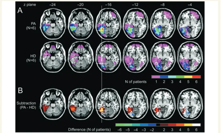 Figure 2A illustrates conventional lesion density plots for the two groups of patients