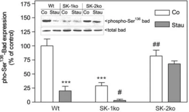 Figure 3 Effect of staurosporine on Bad expression and phos- phos-phorylation in wild-type, SK-1-deficient and SK-2-deficient mouse mesangial cells.