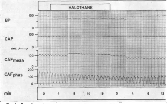 FIG. 8. Recordings of an experiment on the &#34;empty beating&#34; heart (group B), during the administration of halothane 2% for 30 min