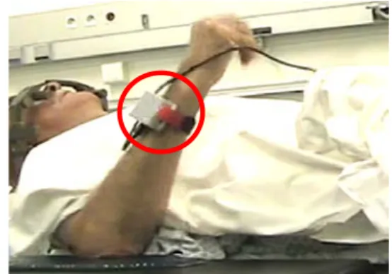 Figure 1: The plastic case containing the accelerometer  tied to the patient's wrist. 