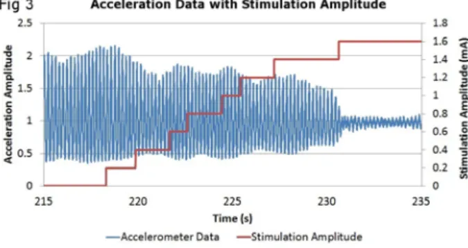 Figure 3: Comparison of different thresholds for one trajecto- trajecto-ry of a DBS patient