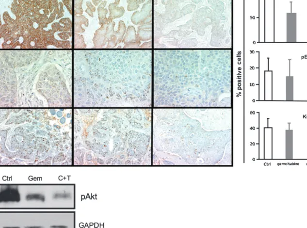 Figure 3. Effect of anti-epidermal growth factor receptor and anti-HER2 monoclonal antibodies (2mAbs) treatment, versus gemcitabine, on the epidermal growth factor receptor (EGFR)expression, EGFR phosphorylation, proliferation index Ki-67 and AKT phosphory