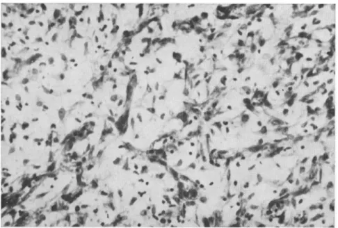 Fig. 2. Histological section of the peripheral zone of a Walker tumour, 8 days after implantation