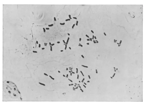Fig. 3. Metaphase plate, 48 hrs after 400 mg/kg MBH. Chromosomal aberrations, in which some of the re- re-combinations are pointed out as tr = translocation (interchange) 
