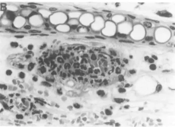 Fig.  1 . (A) and (B) Representative histological appearance of skin lesions of ears 10 days after the i p