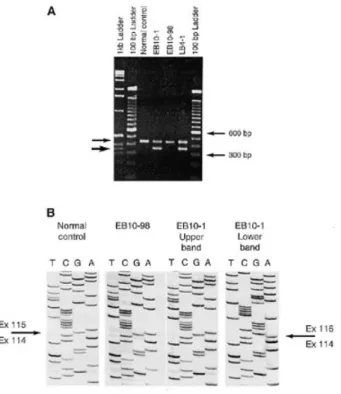 Figure 4. Deletion mutation in the collagen VII gene. (A) Genomic PCR products were generated from normal control, EB10-1, EB10-98, LB4-1 and LB4-3 with primers ColE114 and Col10R