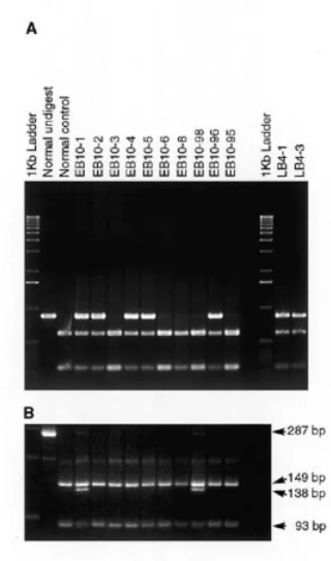 Figure 7. Mutation analysis using RFLP of PCR products from genomic DNA.