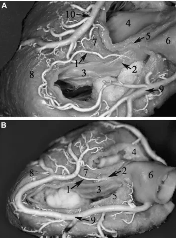 Fig. 1. (A) Dry dissected specimen of the right AV node artery. Note that the right and the left atrium were removed