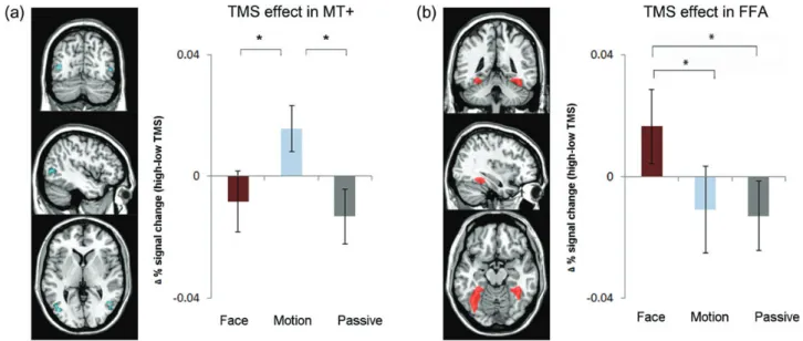 Figure 3. Remote effects of right FEF TMS on BOLD signal for MT+ and FFA are speci ﬁ c to the attended feature