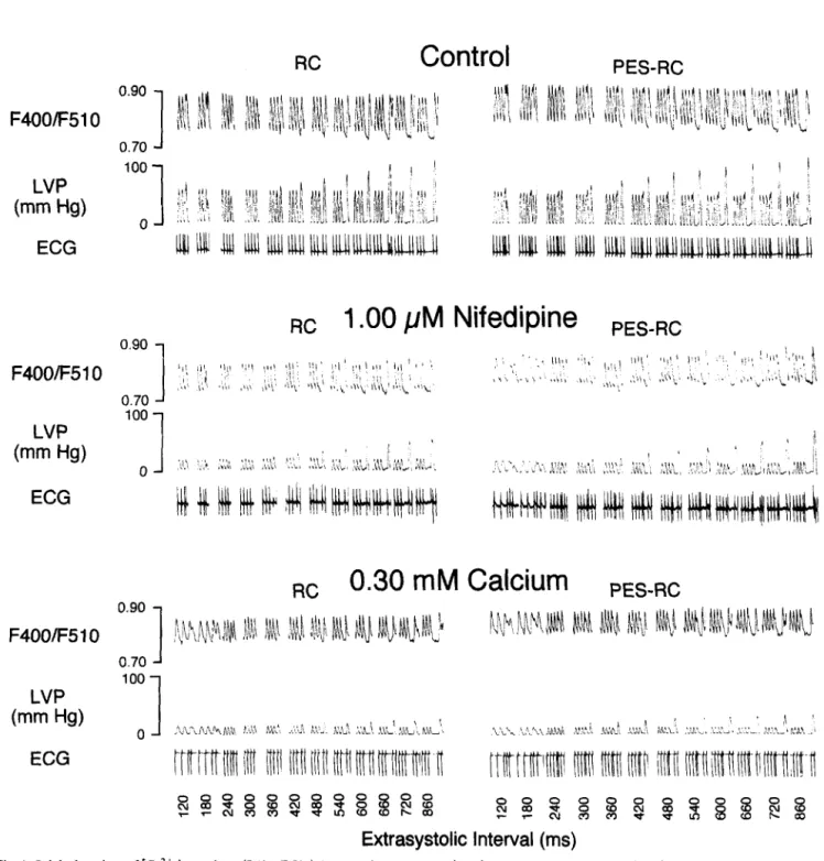 Fig. 1. Original  tracings of [Ca2+ Ii transients (F4OO/F510),  left ventricular  pressure (LVP)  and the electrocardiogram  (ECG)  of isolated perfused rat hearts  during  pacing  protocols  for  restitution  curves CRC) and  postextrasystolic restitution