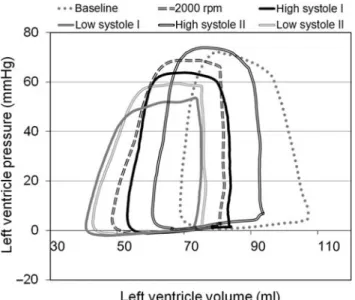 Figure 2: Variation of PV loops due to different pump speed patterns in sheep #1 as a typical example.