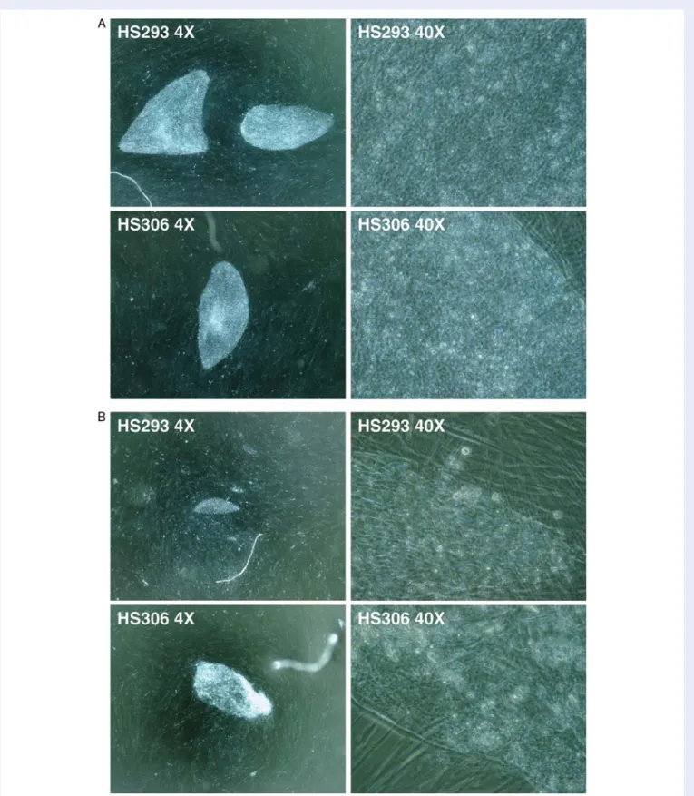 Figure 2 Morphology of hESCs HS293 and HS306 colonies. (A) Typical colonies of cell lines HS293 and HS306 in magniﬁcation 40 and 400 using phase contrast objective (Ph) showed normal morphology with typical characteristics of human embryonic stem cells (hE