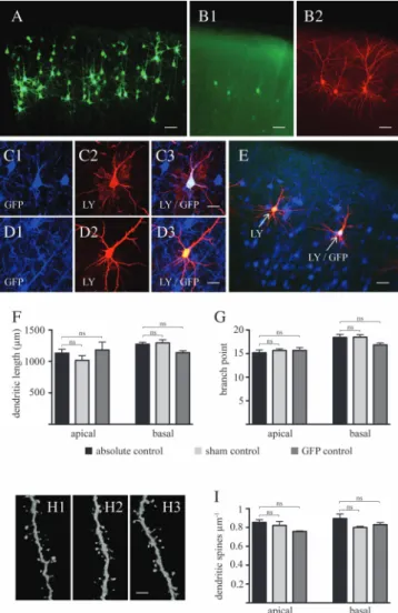Figure 2. In utero electroporation of enhanced green fluorescent protein at ges- ges-tational day 17.5 labels of layer 2/3 pyramidal neurons without affecting physiological patterns of dendritic arbor and spine development