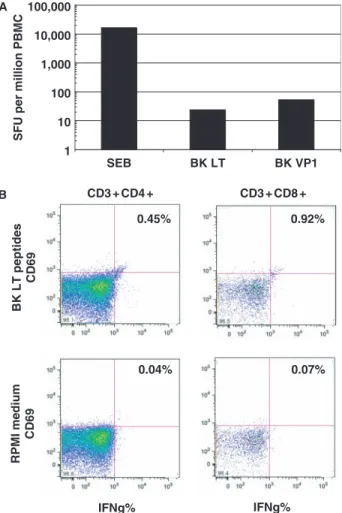Fig. 3. BK-virus-specific interferon-g production in PBMC at resolution of PVAN (i.e. at the time point of the fourth allograft biopsy)