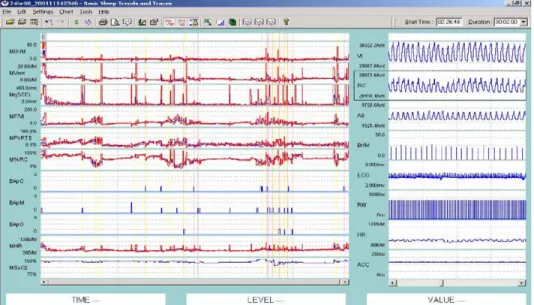 Fig. 4. VivoLogic analysis software example display. Left traces are 1-min medians and quartile ranges of a selected subset of analyzed variables of significance during a night recording