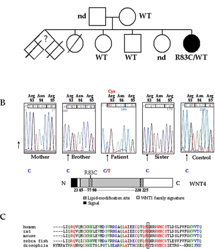 Figure 1. (A) Family tree and DNA sequence chromatograms obtained by direct sequencing of PCR products showing the presence of the heter- heter-ozygote C to T substitution in exon 2, not present in normal individuals (control, representative example out of