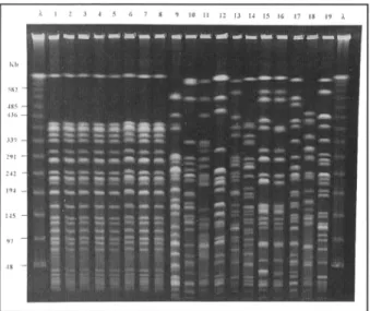 FIGURE 2. Results of pulsed-field gel electrophoresis of Pseudomonas  aeruginosa strains isolated from neonates, healthcare workers (HCWs),  and environmental samples