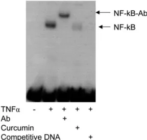 Figure 5. TNF- α  induced nuclear translocation of NF- κ B as ana- ana-lysed by electrophoretic mobility shift assay (EMSA)