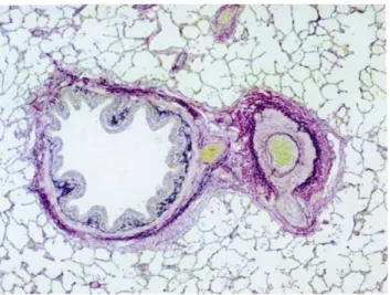 Fig. 4. Histology (van Gieson – elastin stain of the left lung after 12 weeks showing vascular occlusions, plexiform and dilatation lesions.