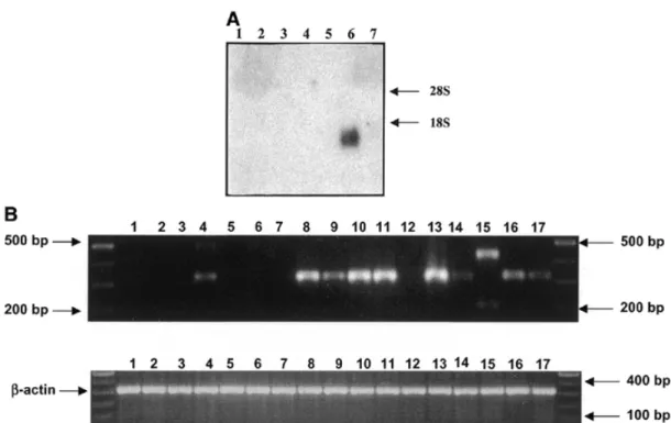 Figure 3. (A) Expression of SLURP-1 mRNA. Northern blot hybridization of RNA from cultured keratinocytes and skin biopsies with a SLURP-1 probe (nucleotides 1852–1991 from GenBank accession no