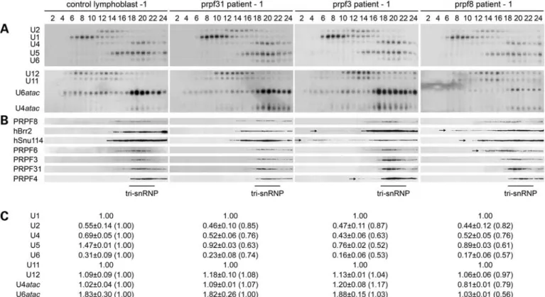 Figure 2. Glycerol gradient fractionation reveals alterations of tri-snRNP composition in RP-PRPF lymphoblasts