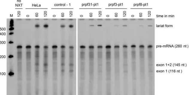 Figure 4. In vitro pre-mRNA splicing is less efficient in extracts from patients with RP