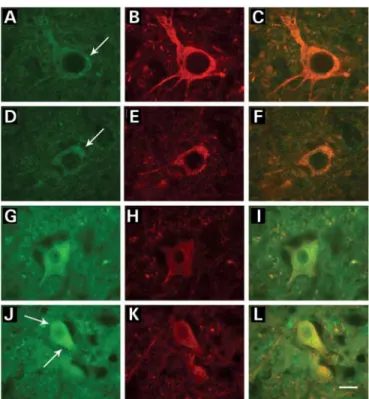 Figure 5. Immunostaining of vimentin and neurofilaments in lumbar spinal cord sections from control and SOD1 G93A mice during the progression of the disease