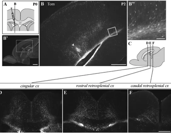 Figure 1. Intraventricular medial lentivector injections at P0 reveal a large pool of labeled radially oriented cells in the medial limbic cortex 2 days after injection