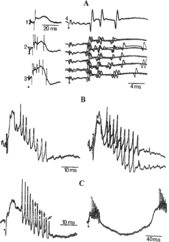 Figure 5. Incremental responses of augmenting type in cortical neurons of cat. A and B, two SI cells driven by VB thalamic stimulation at 1/sec (1) and 10/sec (2)