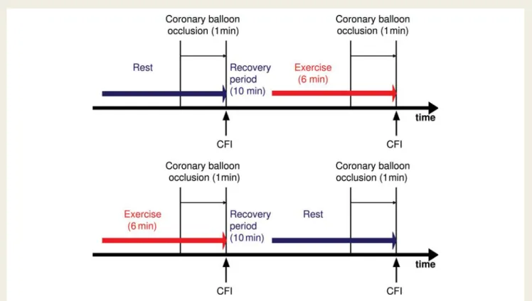 Figure 3 Simultaneous electrocardiogram/pressure tracings obtained in the proximal left anterior descending coronary artery during supine bicycle exercise (left side; patient of the ‘exercise first’ group) and at rest (right side)