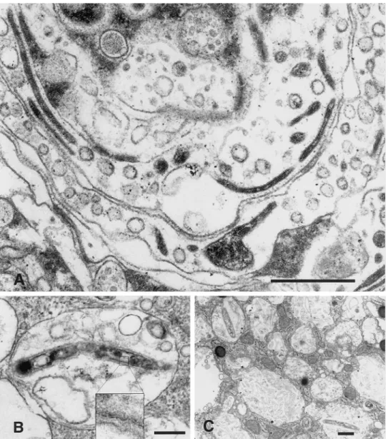 Figure 2. Electron micrographs showing Whipple bacilli cultured in deactivated human macrophages and SigM5 monoblast cells