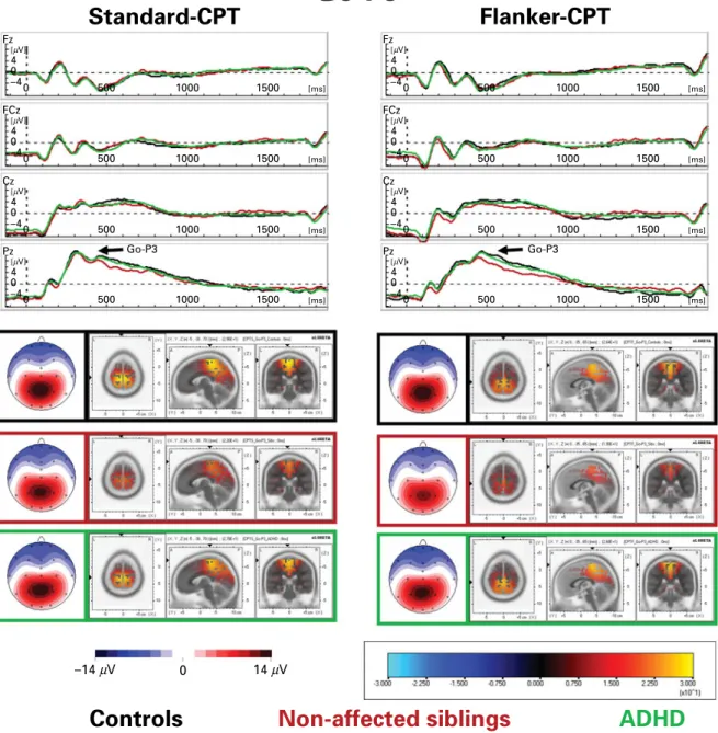 Fig. 3. Topography and sources of the Go-P3. Stimulus-locked grand average waves of controls, non-aﬀected siblings and attention deﬁcit-hyperactivity disorder (ADHD) patients with spline-interpolated Go-P3 maps evoked by cued targets with correct responses