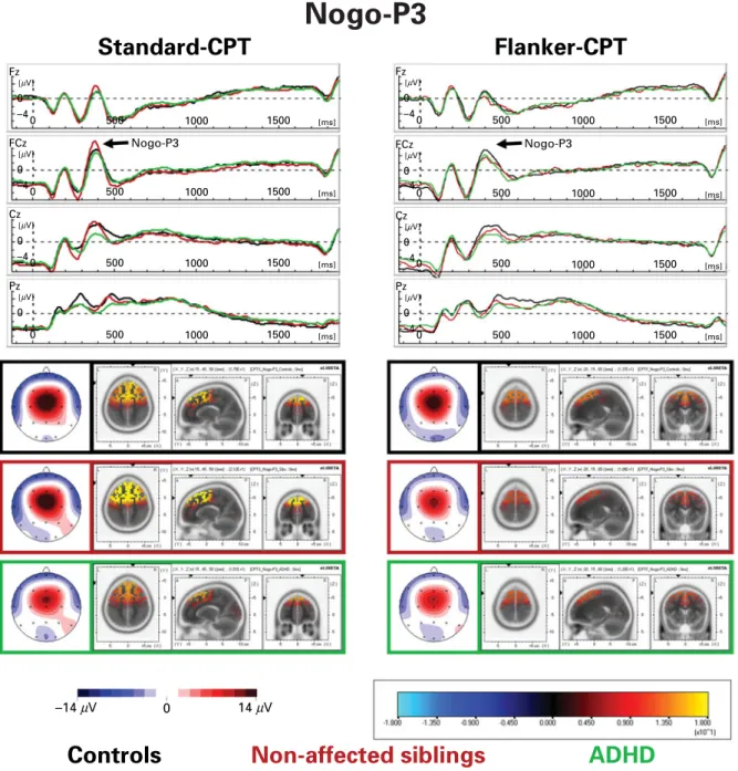 Fig. 4. Topography and sources of the NoGo-P3. Stimulus-locked grand average waves of controls, non-aﬀected siblings and attention deﬁcit-hyperactivity disorder (ADHD) patients with spline-interpolated NoGo-P3 maps evoked by cued non-targets with correctly