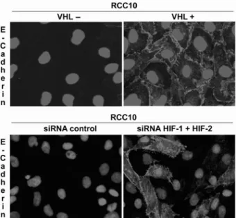 Fig. 9 The VHL-HIF pathway regulates expression of the cell adhesion molecule E-cadherin in renal cells