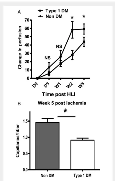 Figure 1 Perfusion recovery is impaired in untreated Type 1 DM mice and associated with decreased capillary density in Week 5  post-ischaemic (A) impaired perfusion recovery in untreated type 1 diabetes mellitus (DM1)