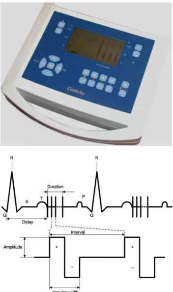 Fig. 1. Device for driving muscular contraction using trains of multiple biphasic electrical impulses applied during early diastole