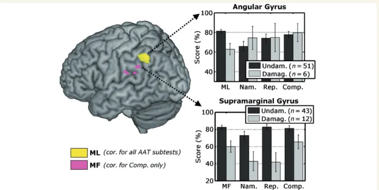 Figure 4 Surface rendering displaying regions associated with praxic effects when potential linguistic confounds are accounted for.