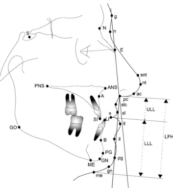 Figure 1  Reference points and lines used in the cephalometric analysis. 