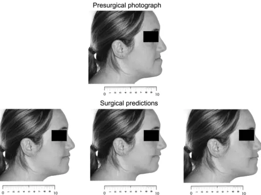 Figure 2  The mark sheet with the pre-surgical profile photograph on the top of the page with the three surgical  predictions below in random order