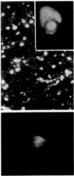 Table 1. Detection of MV structural proteins in brain cells by double-labeling immunofluorescence.