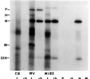 Figure 3. In vitro translation of mRNAs derived from control brain (CB), lytic MY (MV), or brain tissue from a patient with MIBE (MIBE)
