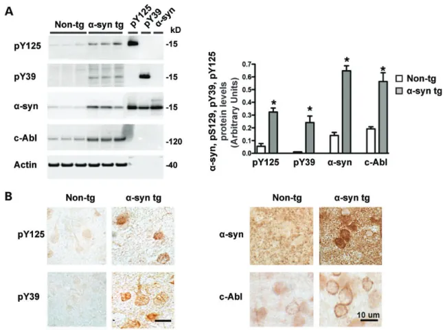 Figure 3. Both c-Abl and phosphorylated a-syn (at Y39 or Y125) levels are increased in a-syn transgenic mice