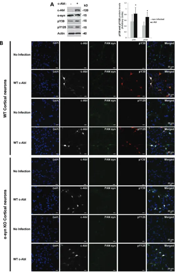 Figure 5. c-Abl induces a-syn phosphorylation at Y39 and Y125 residues in primary cortical neurons
