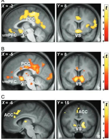 Figure 3. Neural correlates of SSL-based EV, RPE, and decision con ﬂ ict. ( A ) EV during the decision phase was associated with fMRI signals in VS, vmPFC, and PCC.