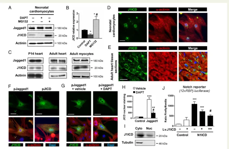 Figure 1 Jagged1 cleavage in cardiomyocytes produces J1ICD. (A) Neonatal cardiomyocytes were treated with either DAPT (10 mM) or MG132 (10 mM) for 12 h