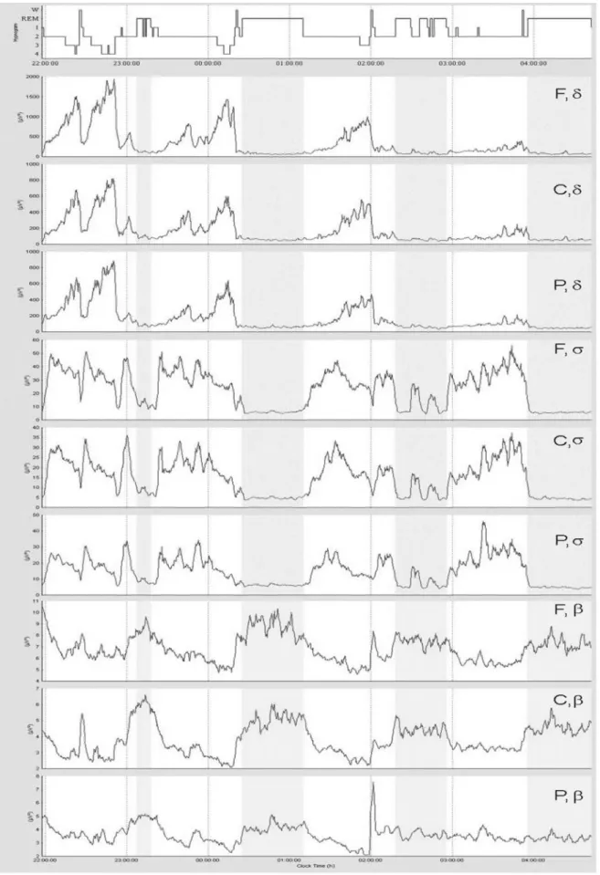 Figure 2. Power time-courses for a typical subject, across four NREM–REM sleep cycles for the delta ( δ ), sigma ( σ ) and beta ( β ) frequency bands measured at frontal (F), central (C) and parietal (P) sites, together with the corresponding hypnogram in 