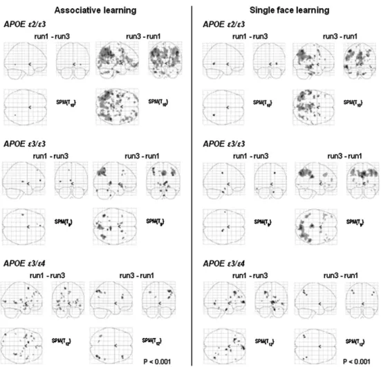 Figure 7. Simple regression between left hippocampal signal difference during associative learning (run 1--run 3) and associative retrieval performance computed for APOE e3/e4 (left panel) and APOE e2/e3 carriers (right panel)