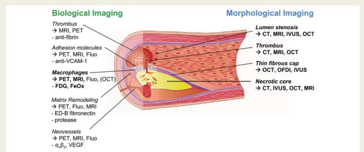 Figure 4 Techniques for imaging the unstable plaque. This scheme illustrates morphological and biological tools for visualizing vulnerable plaques